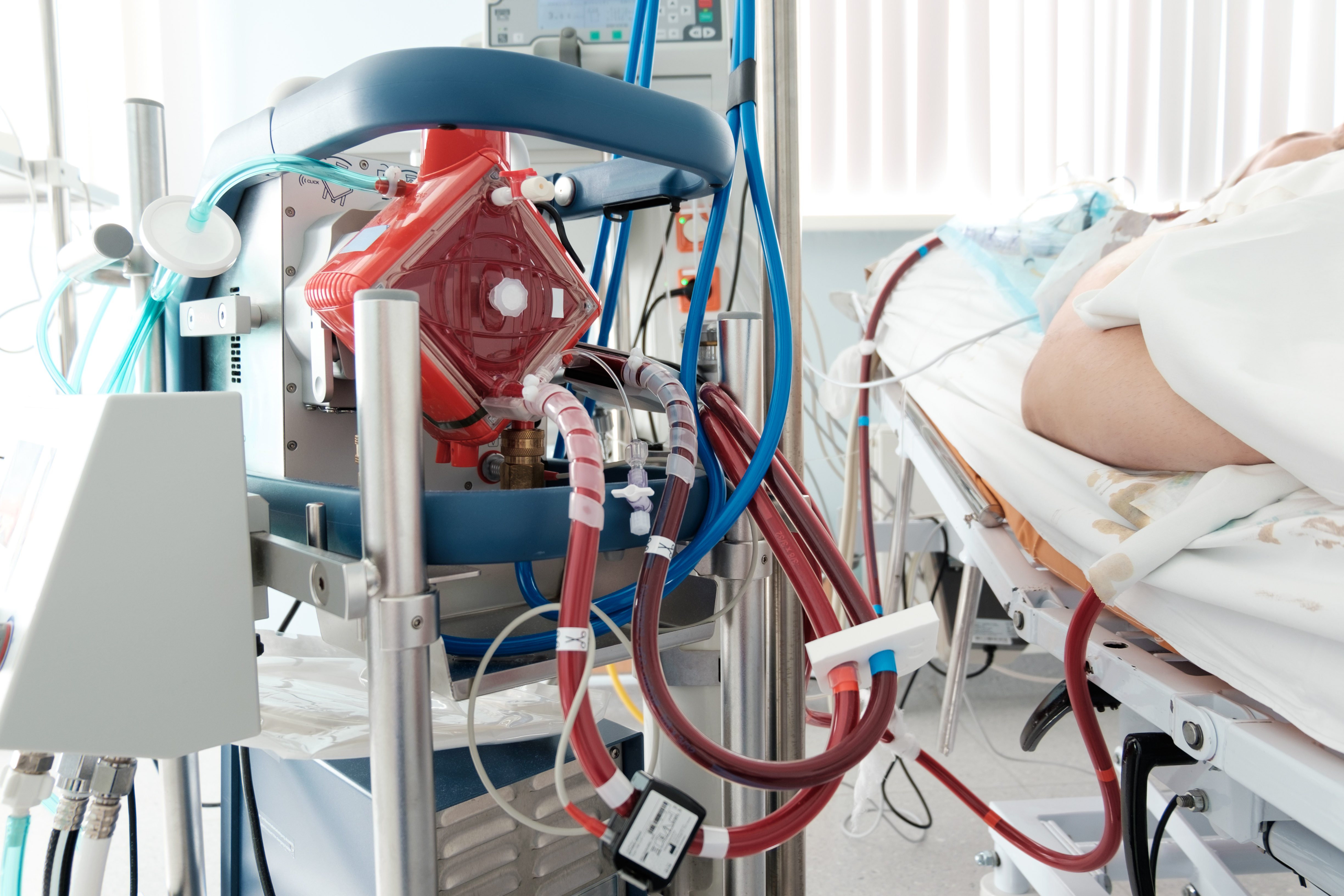 ECMO machine in use in the intensive care unit